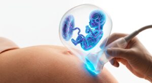 3D 초음파 검사를 받는 산모의 모습과 태아의 형상을 시각화한 의학 일러스트